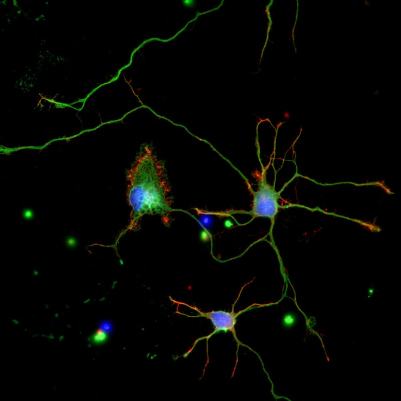 Neurons-25mm-FOV_16cols.jpg